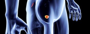 prostata dott alina di ronza