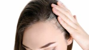 I capelli Bianchi dott alina di ronza