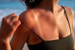 sole: pelle chiara o pelle scura